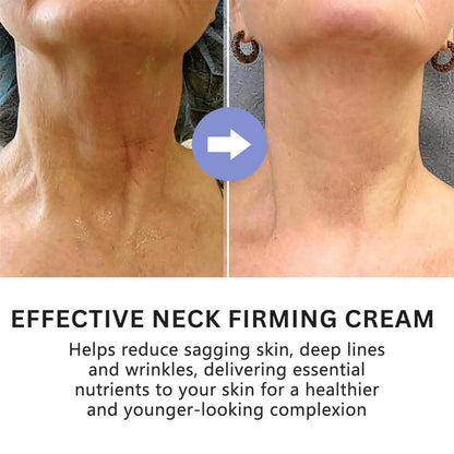 NECK LIFTING CREAM