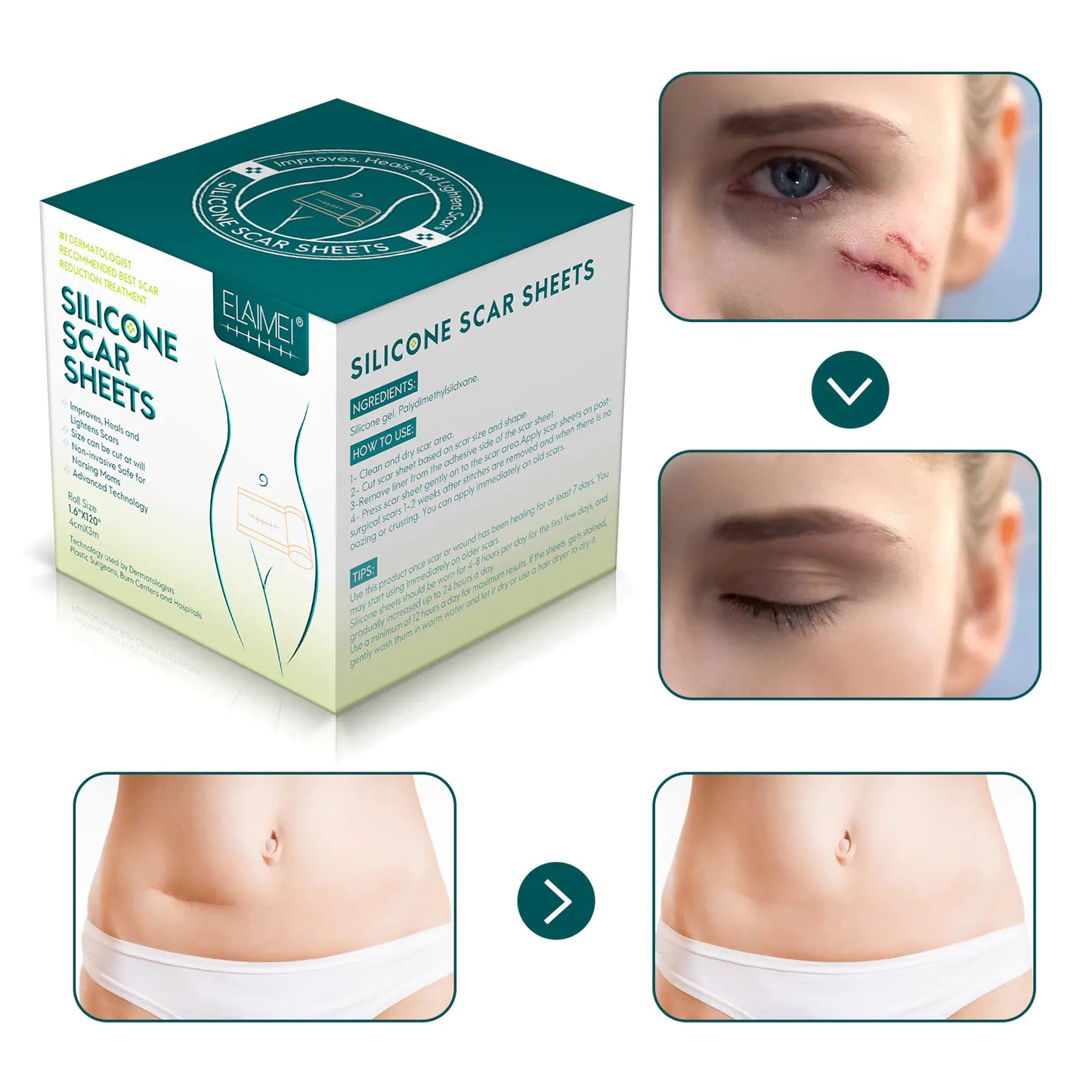 SILICONE GEL SCAR PATCH
