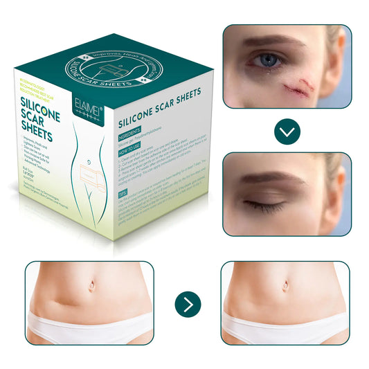 SILICONE GEL SCAR PATCH