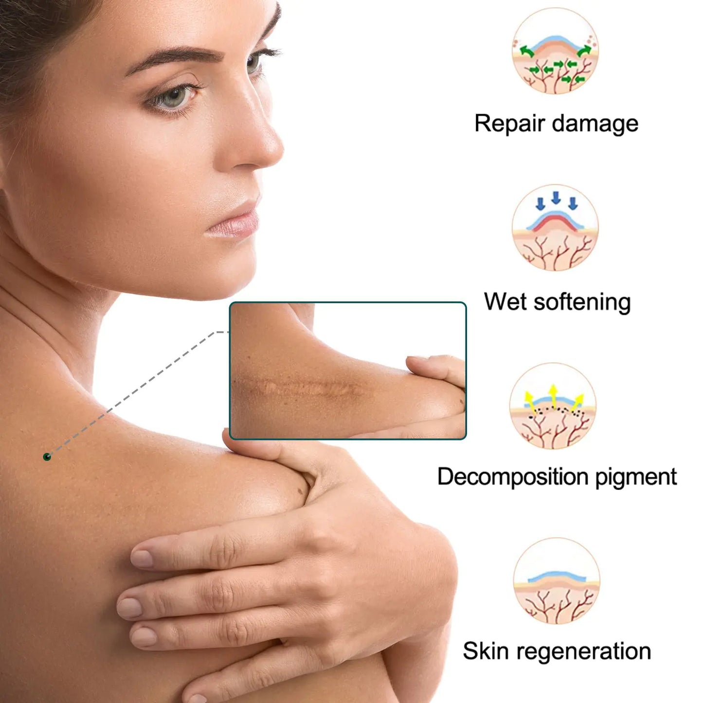 SILICONE GEL SCAR PATCH